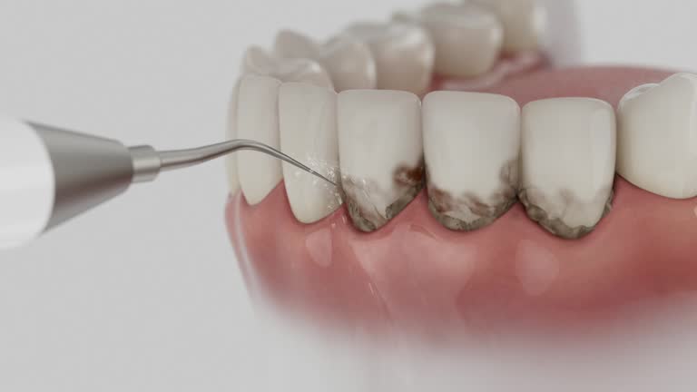 Reliable Emergency Dentist contractor in Gresham, OR by Smile Center Dentistry